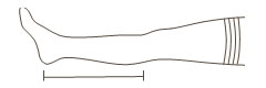 Podkolanówki kompresyjne - pomiar długości podklanówki
